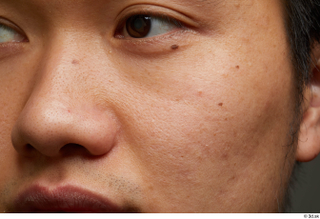 HD Face Skin Lan cheek eye face nose skin pores…